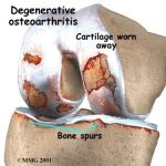 photo of knee joint