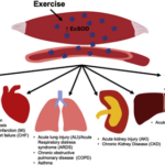 exercise and covid diagram